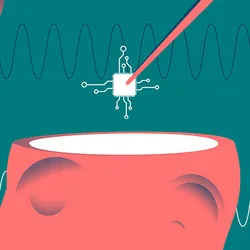 Vector illustration of implanting of brain chips into human head. 
