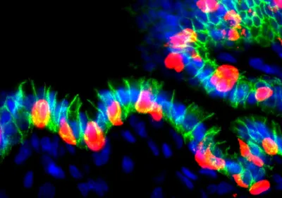 Blue, green, and red dots make a worm-like shape against a black background, signifying human organoids grafted in mice that secreted insulin. Blue, green, and red dots make a worm-like shape against a black background, signifying human organoids grafted in mice that secreted insulin.
