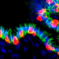 Blue, green, and red dots make a worm-like shape against a black background, signifying human organoids grafted in mice that secreted insulin. 
