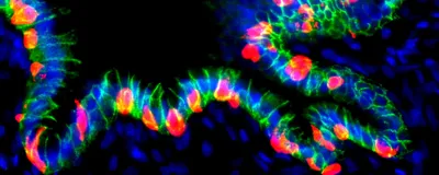 Blue, green, and red dots make a worm-like shape against a black background, signifying human organoids grafted in mice that secreted insulin. Blue, green, and red dots make a worm-like shape against a black background, signifying human organoids grafted in mice that secreted insulin.