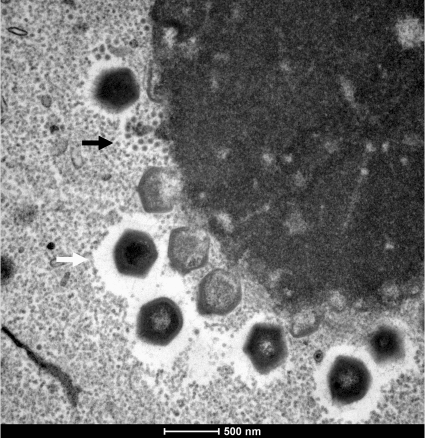 An electron microscope image shows giant viruses next to other smaller viruses infecting a cell.