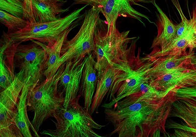 An immunofluorescence image of skin fibroblasts colored in green, red, and blue is shown. An immunofluorescence image of skin fibroblasts colored in green, red, and blue is shown.