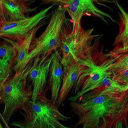 An immunofluorescence image of skin fibroblasts colored in green, red, and blue is shown.