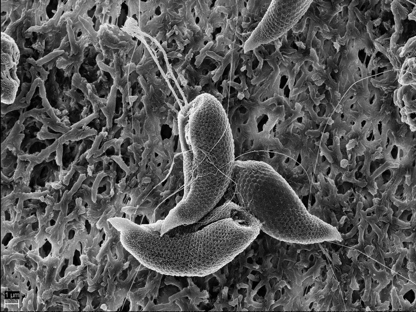 Grayscale microscopic image of a cluster of three phytoplankton. They are shaped like long chili peppers and have bumpy exteriors like a raspberry. Grayscale microscopic image of a cluster of three phytoplankton. They are shaped like long chili peppers and have bumpy exteriors like a raspberry.