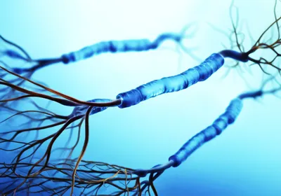 Graphic of neurons showing the myelin sheaths affected by multiple sclerosis