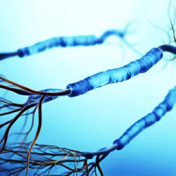 Graphic of neurons showing the myelin sheaths affected by multiple sclerosis Graphic of neurons showing the myelin sheaths affected by multiple sclerosis