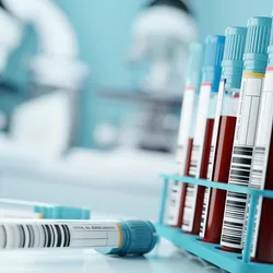 Blood sample tubes sit in a rack on a laboratory bench.