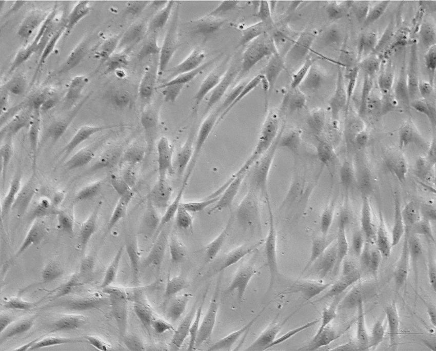 Spindle-shaped cells in dark gray color against a light gray background, signifying dental pulp stem cells from exfoliated deciduous teeth.