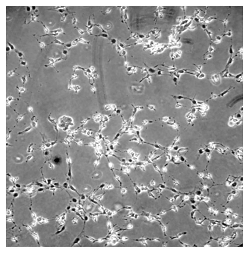 Dark gray neuron-like cells against a light gray background, signifying that dental pulp stem cells can differentiate into neuron-like cells.