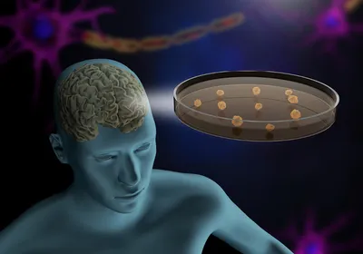 Illustration of human neural organoids in a dish.