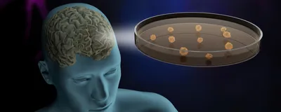 Illustration of human neural organoids in a dish.