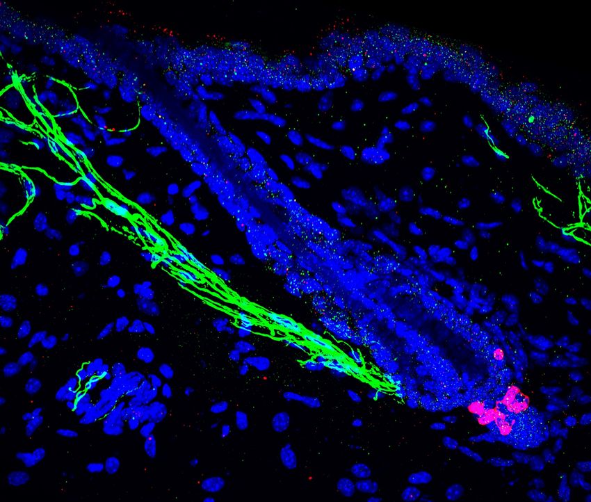 Fluorescent image of a hair follicle with melanocyte stem cells (magenta) innervated with nerves (green).
