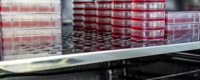 Various cell culture containers, including dishes and flasks, filled with media and stacked inside an incubator. Various cell culture containers, including dishes and flasks, filled with media and stacked inside an incubator.