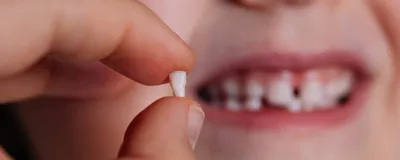 A child holds one of her baby teeth that fell out between her thumbs while smiling with a gap in her teeth. 