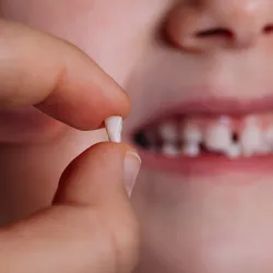 A child holds one of her baby teeth that fell out between her thumbs while smiling with a gap in her teeth. 