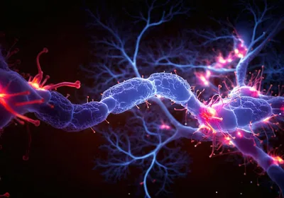 3D rendered image of a neuron cell network on a black background, signifying demyelination that takes place in multiple sclerosis.