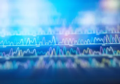 An image of a DNA sequencing spectrum with a radial blur filter applied. An image of a DNA sequencing spectrum with a radial blur filter applied.