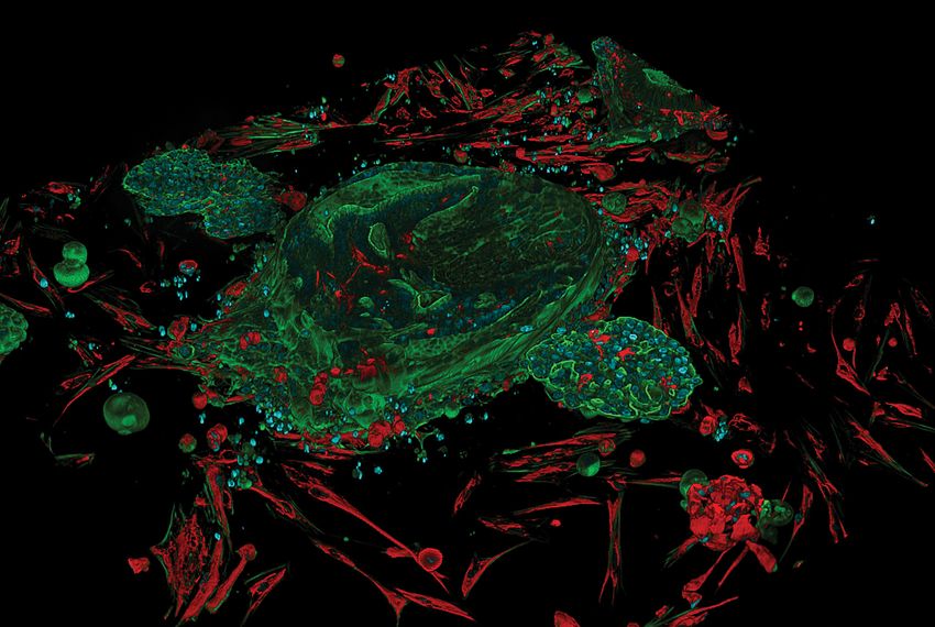 A few green, blue, and red-colored cells against a black background.