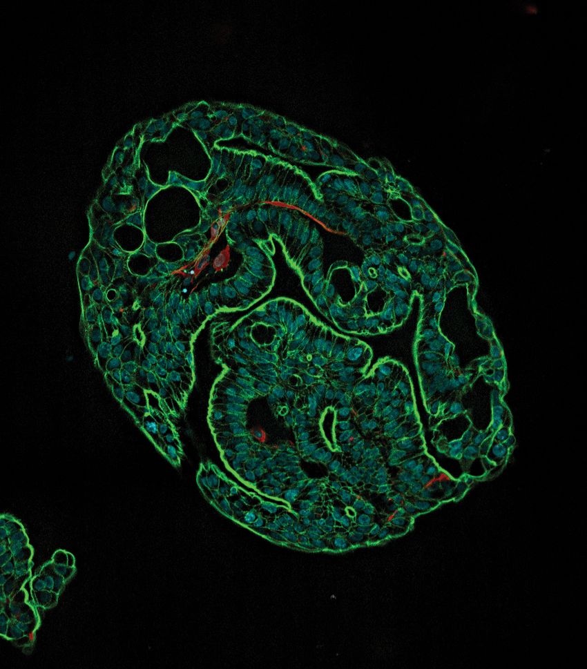 A few green, blue, and red-colored cells against a black background.