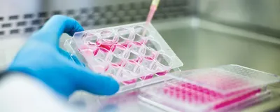 A researcher passes cells in a biosafety cabinet while wearing blue gloves and a white lab coat.