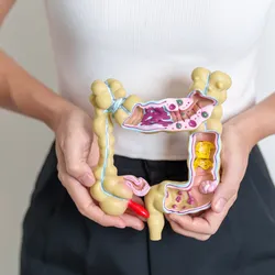 Woman holding human colon anatomy model, signifying ulcerative colitis caused due to a bacterial toxin that attacks intestinal macrophages.