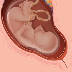 Illustration of a uterus with a near-term fetus inside of it, surrounded by the amniotic sac that will be filled with amniotic fluid. The placenta is at the top of the uterus, with red and blue veins and arteries.