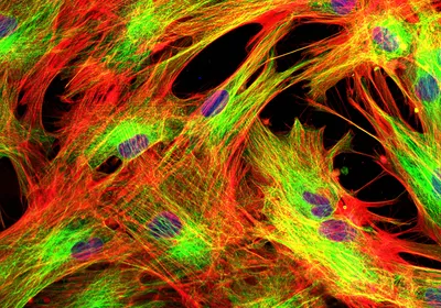 A confocal microscope image of stained fibroblasts on a black background.