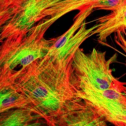 A confocal microscope image of stained fibroblasts on a black background. A confocal microscope image of stained fibroblasts on a black background.
