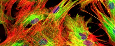 A confocal microscope image of stained fibroblasts on a black background.
