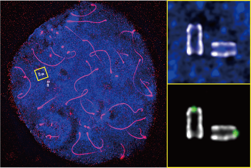 A bluish ball depicting DNA containing red strands depicting chromosome axes and a few white structures. The white structures are zoomed into on the right.