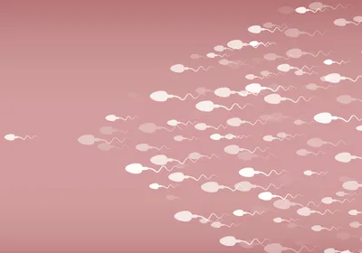 A picture of white sperm cells moving towards the left side on a pinkish background. Centriole defects lead to improper flagellum formation in sperm, causing infertility.