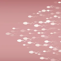 A picture of white sperm cells moving towards the left side on a pinkish background. Centriole defects lead to improper flagellum formation in sperm, causing infertility.