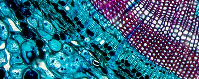 A cross section of a pine stem shows cells stained purple and blue.