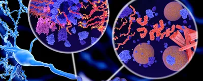 Alzheimer: Phosphorylation of Tau proteins leads to disintegration of microtubuli in a neuron axon stock photo