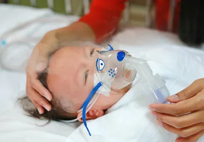 baby receives nebulization, signifying RSV infection that shapes allergic asthma risk later in life. 