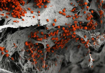 A scanning electron microscopy image shows a scaffold imitating the bone surrounding the bone marrow with blood cell organoids derived from human induced pluripotent stem cells (red). 