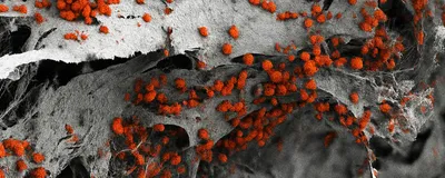 A scanning electron microscopy image shows a scaffold imitating the bone surrounding the bone marrow with blood cell organoids derived from human induced pluripotent stem cells (red). 