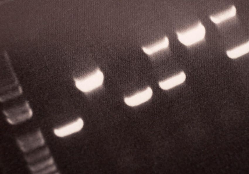 Image of stained nucleic acid samples within an agarose gel Image of stained nucleic acid samples within an agarose gel