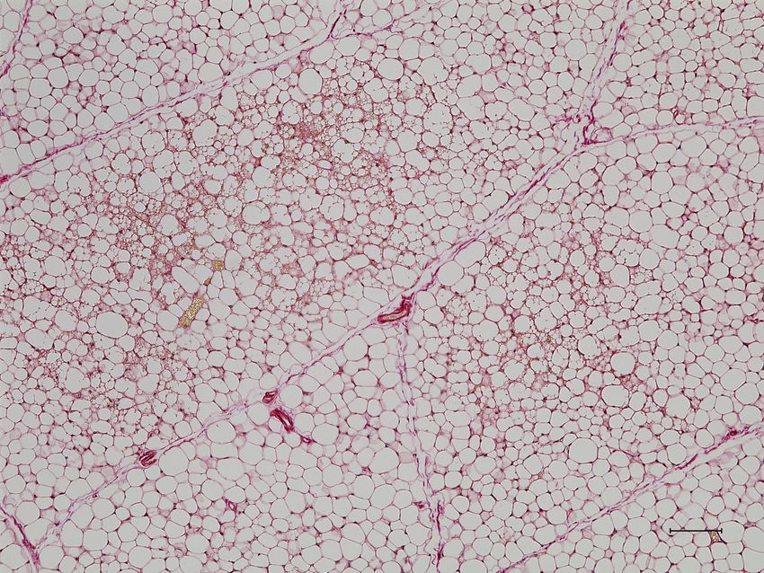 A microscopy image showing white rounded cells with pink borders. A microscopy image showing white rounded cells with pink borders.