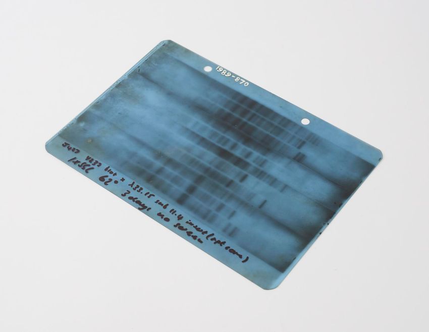 An X-ray image of a gel obtained by Southern blot, which resembles a barcode, of an individual’s characteristic DNA pattern.