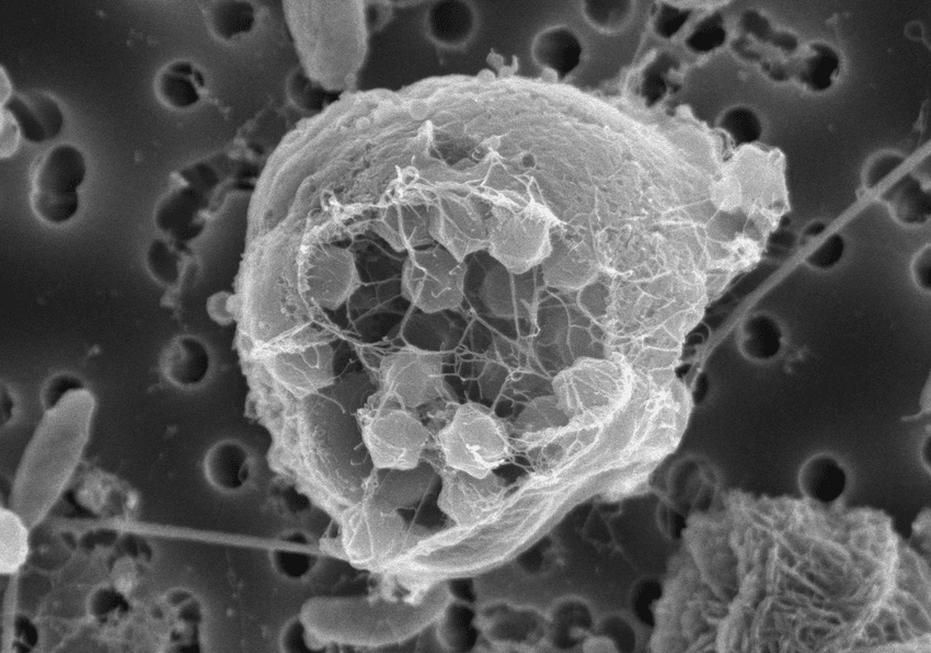 A grey scanning electron micrograph shows a large cell of a round marine algae, with hexagonal giant virus particles bursting out of it.
