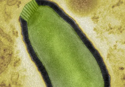 The green zombie virus under the microscope, on a mottled yellow background. 