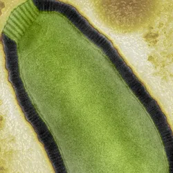 The green zombie virus under the microscope, on a mottled yellow background. 