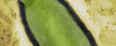 The green zombie virus under the microscope, on a mottled yellow background. 