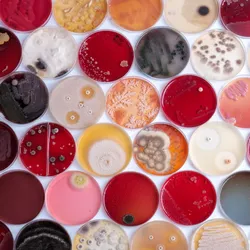 Rows of colorful petri dishes show different microorganisms, including bacteria and fungi, growing on various nutrient media.