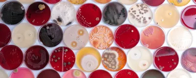 Rows of colorful petri dishes show different microorganisms, including bacteria and fungi, growing on various nutrient media.