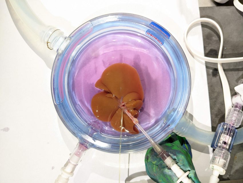 A red-colored liver floats in pink medium. A syringe is inserted into the liver.