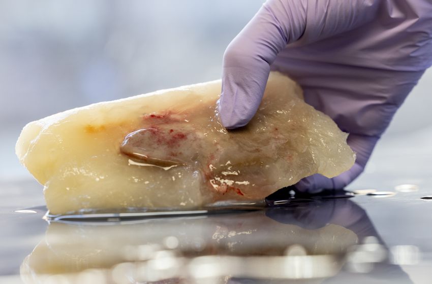 A bloody organ is embedded in a block of ice held in a purple-colored gloved hand.