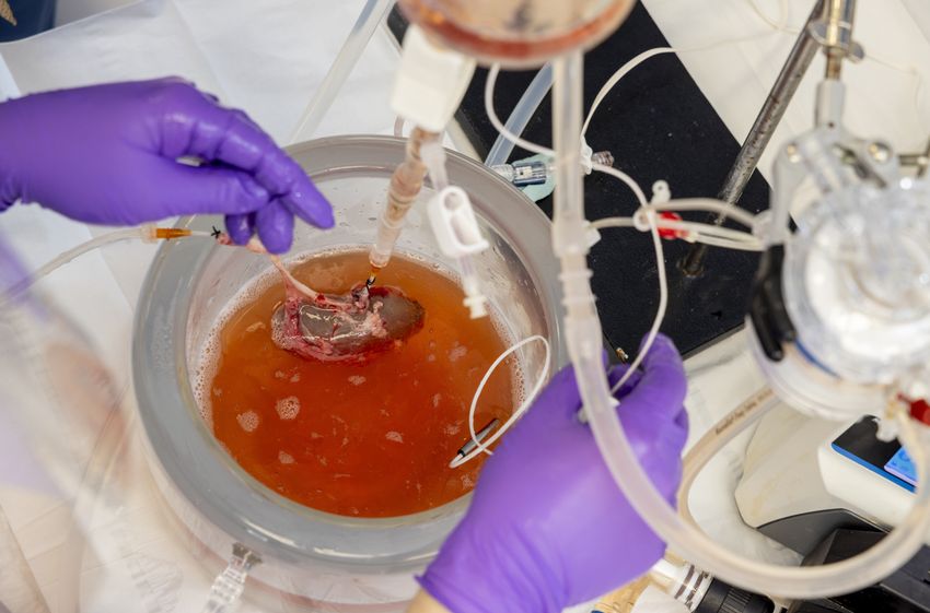 A dark red-colored kidney floats in red medium in a complicated setup. Two purple-colored gloved hands are seen.
