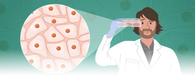 An illustration of James Trosko, now a cancer biologist at Michigan State University, with long brown hair and close beard wearing a white lab coat on the right of the image. He is holding a cell culture plate and looking at it inquiringly. On the left is a call out showing where, in the cell culture dish, pink, irregular cells are sitting close to one another. The background is an image of these same cells in a green overlay. An illustration of James Trosko, now a cancer biologist at Michigan State University, with long brown hair and close beard wearing a white lab coat on the right of the image. He is holding a cell culture plate and looking at it inquiringly. On the left is a call out showing where, in the cell culture dish, pink, irregular cells are sitting close to one another. The background is an image of these same cells in a green overlay.